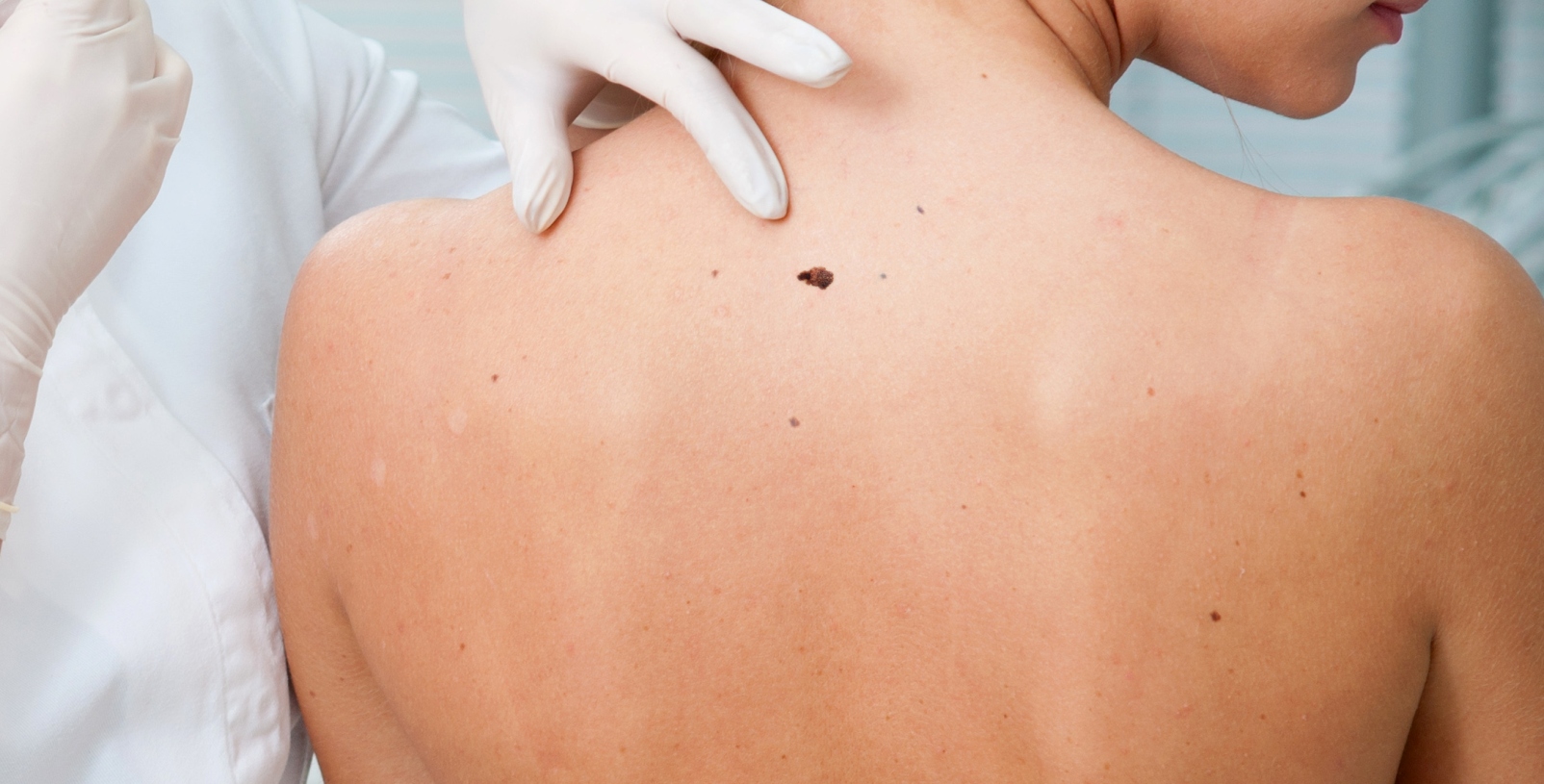 doctor inspecting woman patient skin