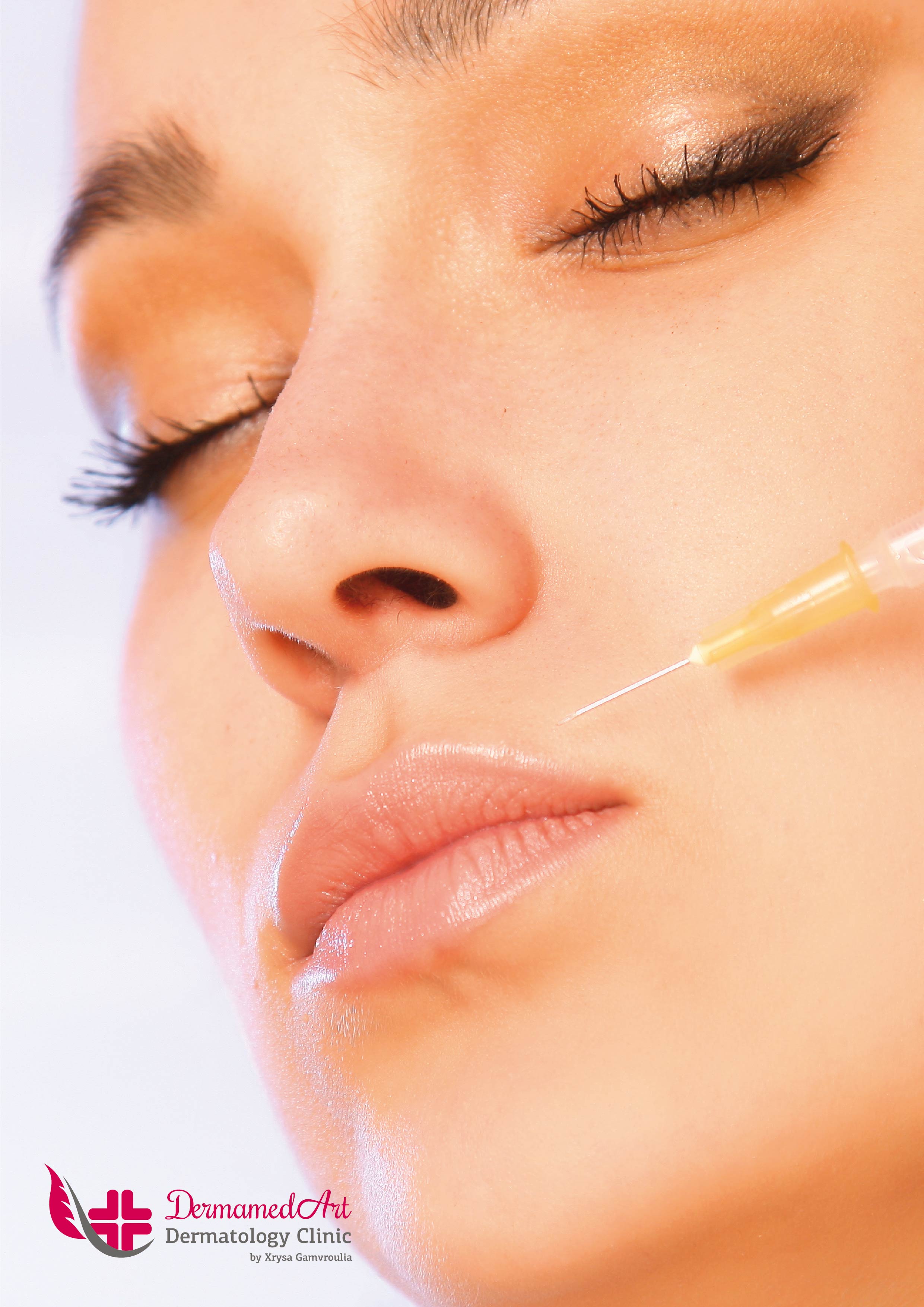 FILLERS ΕΜΦΥΤΕΥΜΑΤΑ ΥΑΛΟΥΡΟΝΙΚΟ